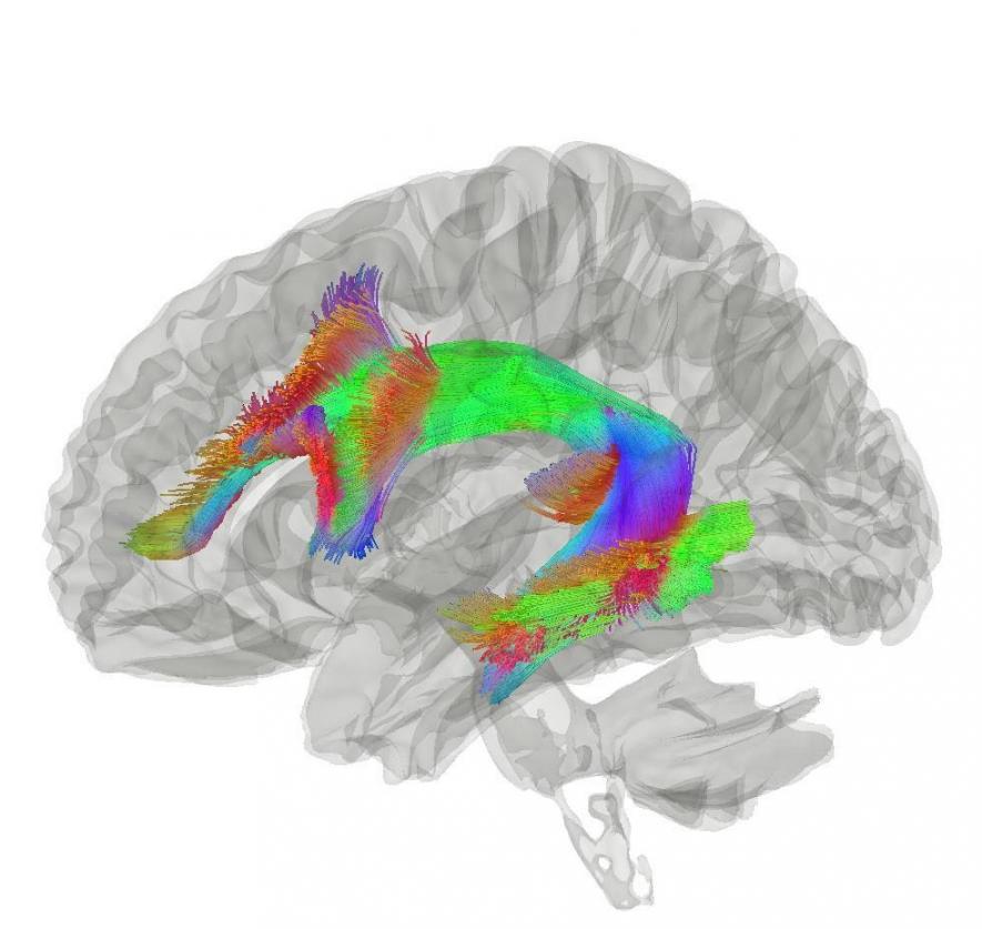How Old Is Origin of Language in Human Brain?