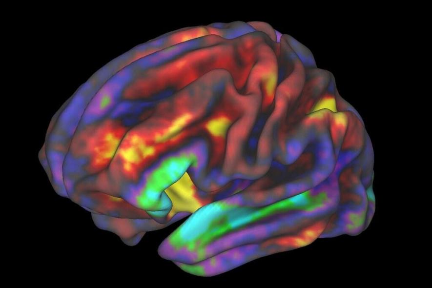 brain