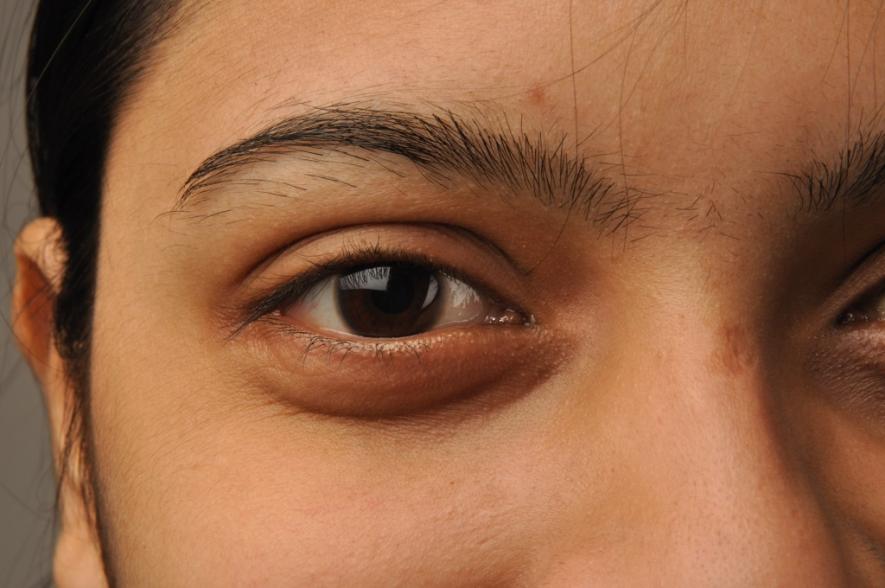 Eye Bank